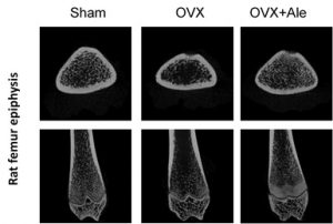 microct bone density