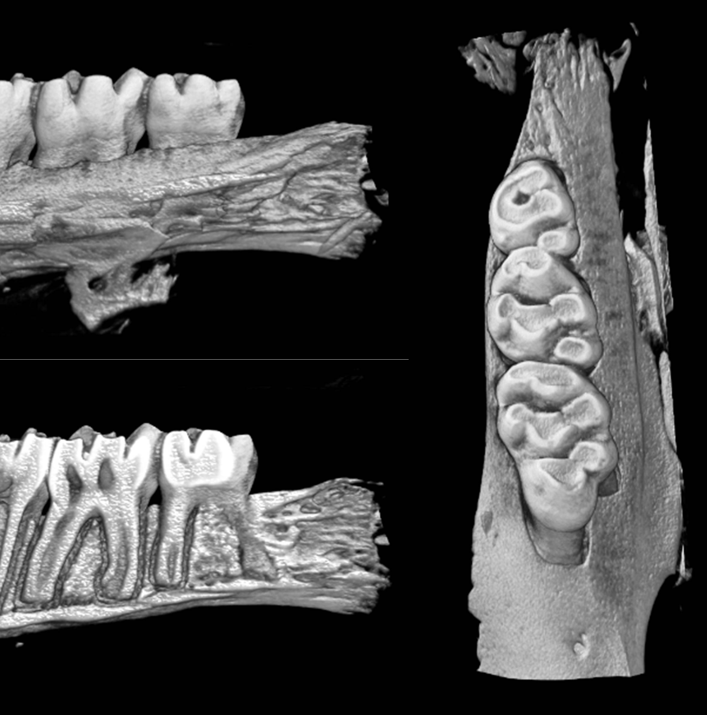alveolar bone evaluation