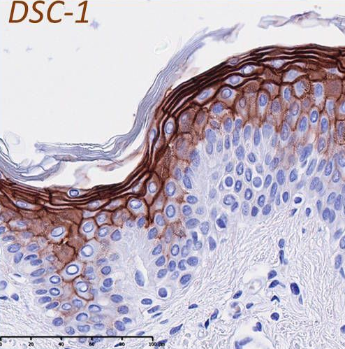 dsc1 histology