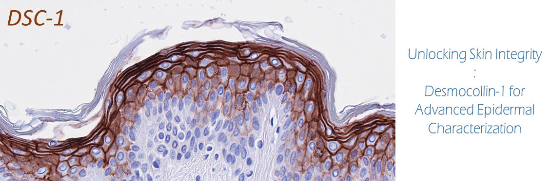 dsc1 histology skin