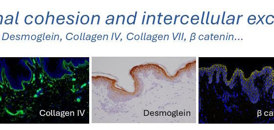 intercellular skin histology