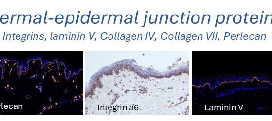 junction skin histology