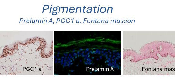 pigmentation skin histology
