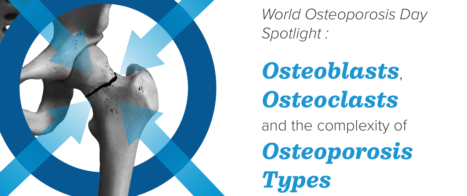 banner osteoporosi article