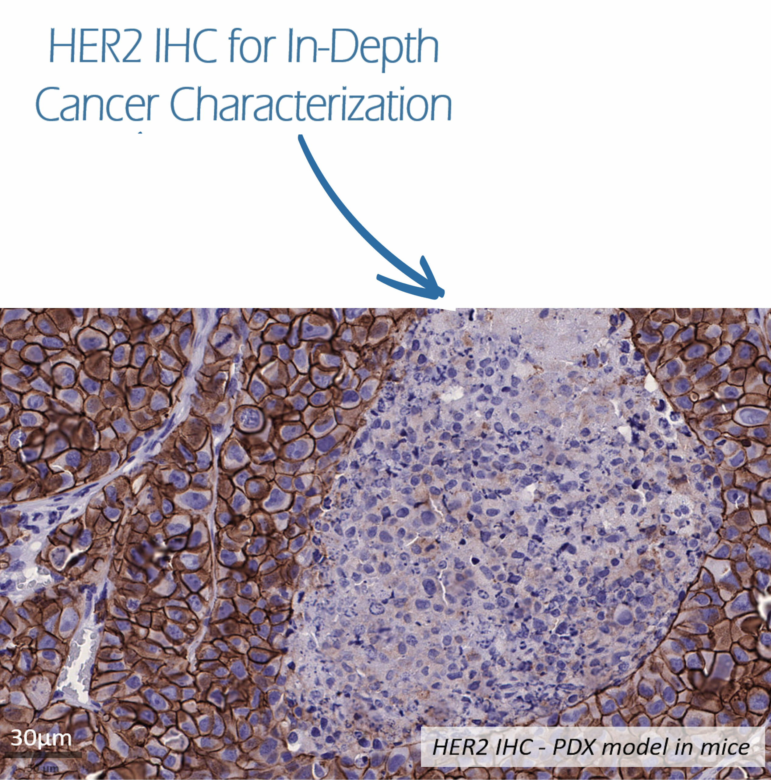 HER2 IHC for In-Depth Cancer Characterization