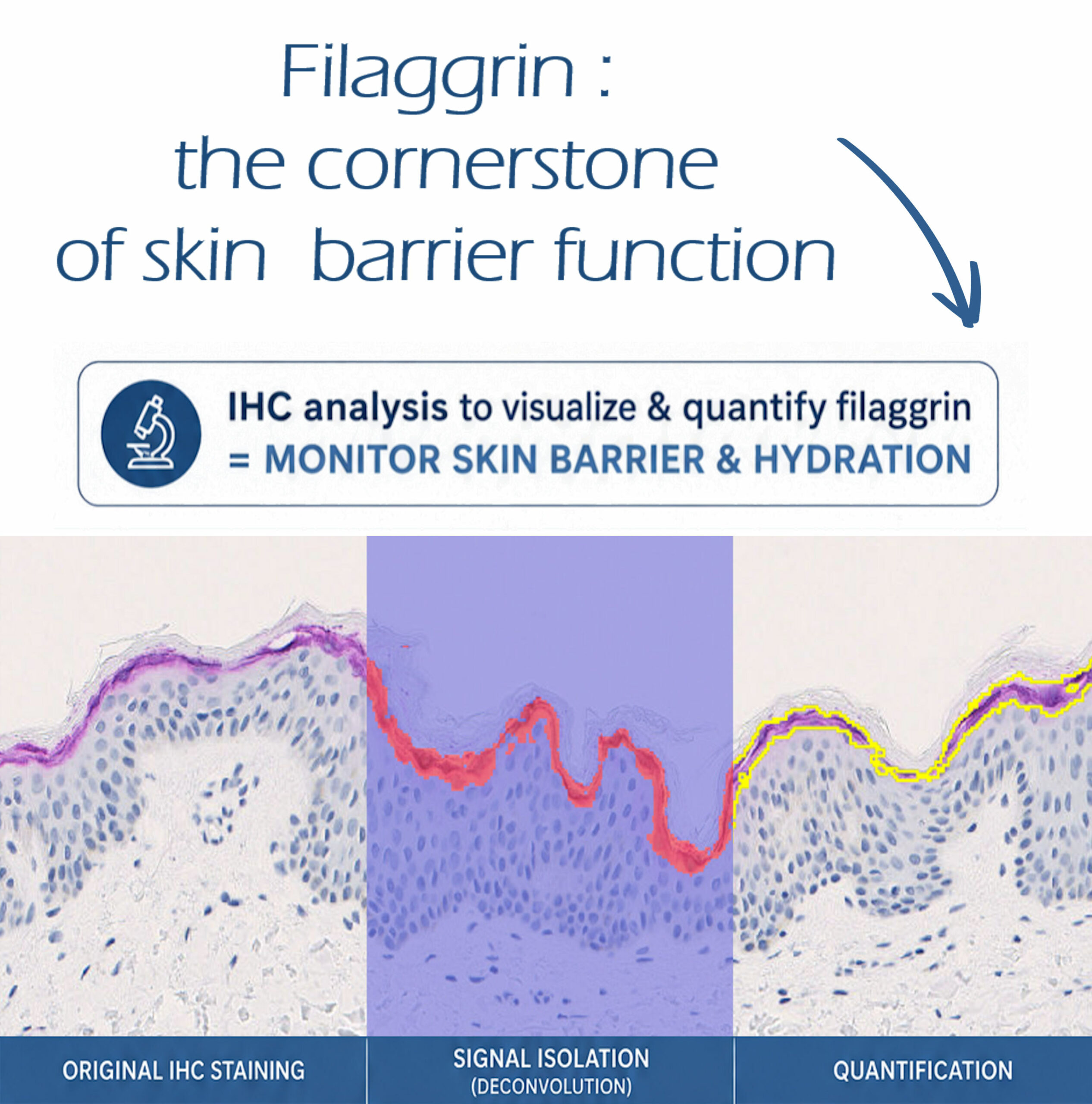 Filaggrin : the cornerstone of skin  barrier function