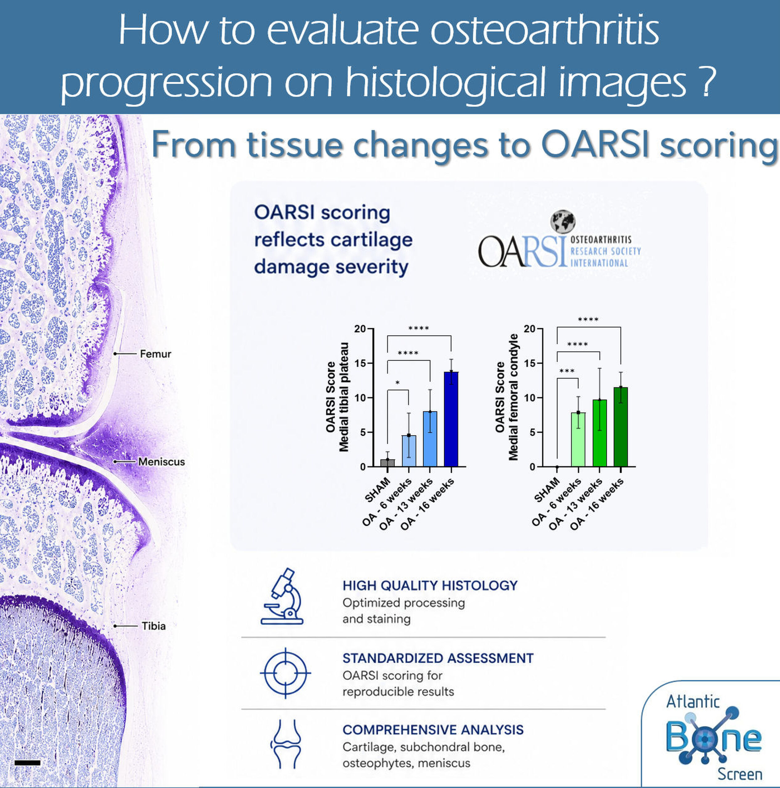 World Osteoarthritis Day, the power of histology to evaluate OA progression