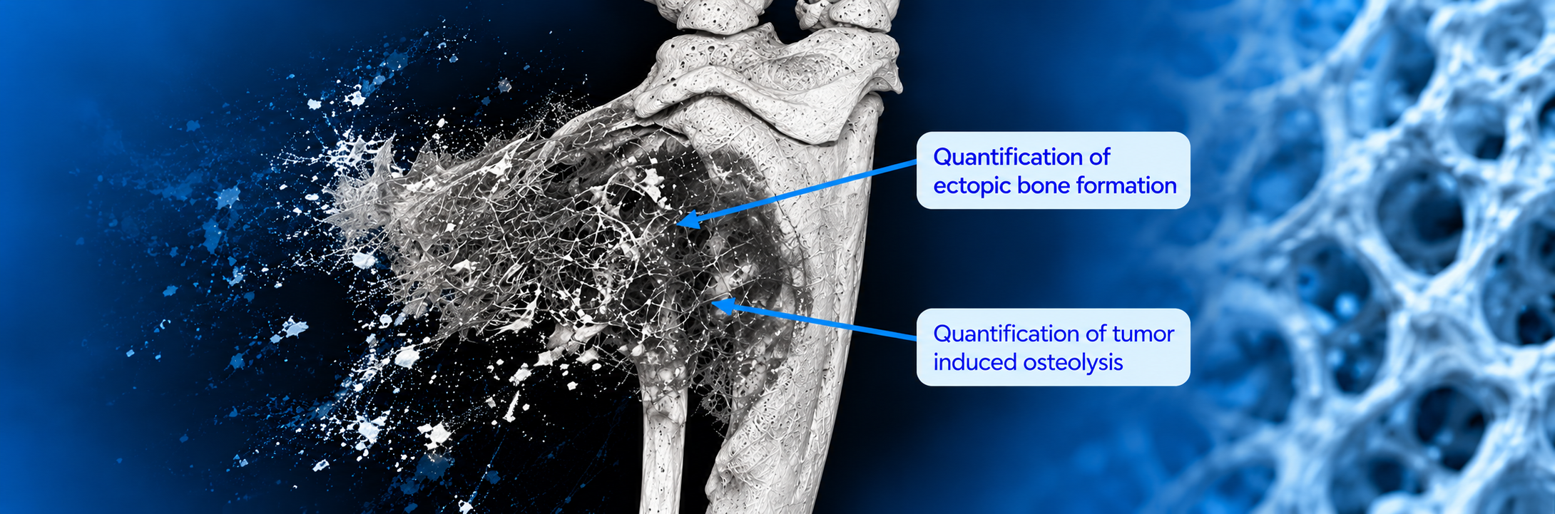 quantification de la formation osseuse ectopique