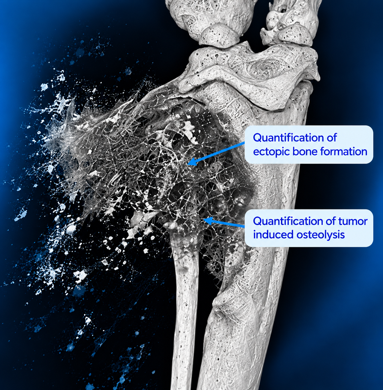 World Arthritis day 2026