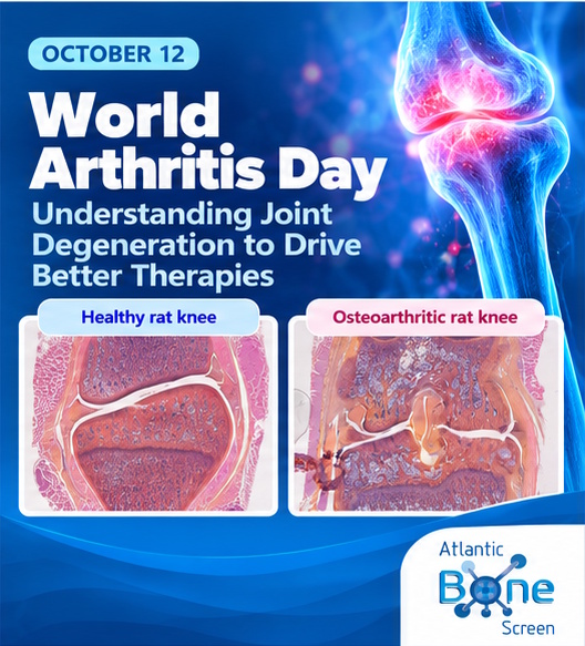 World Arthritis day 2026